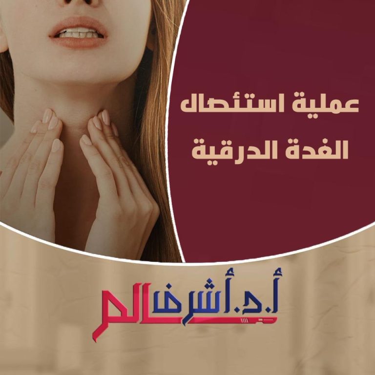 استئصال الغدة الدرقية