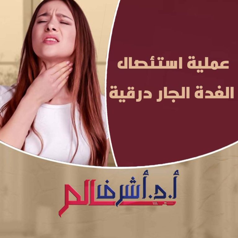 استئصال الغدة الجار درقية