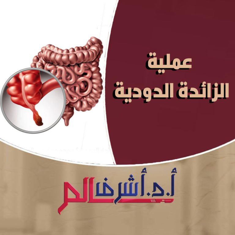 الزائدة الدودية