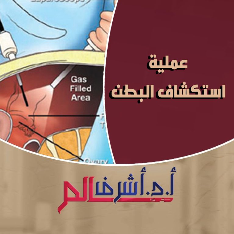 عمليات استكشاف البطن