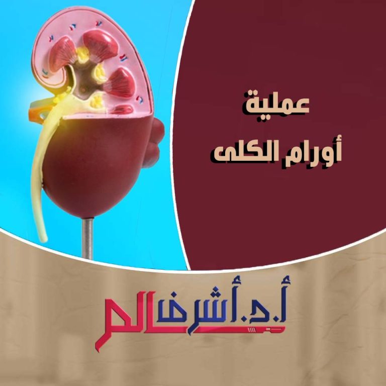 أورام الكلى