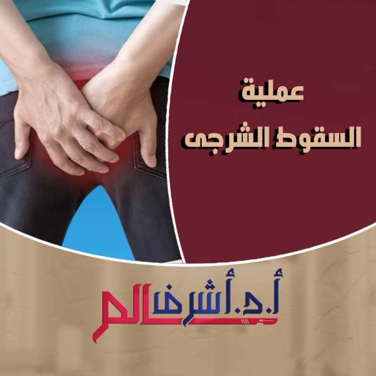 السقوط الشرجي