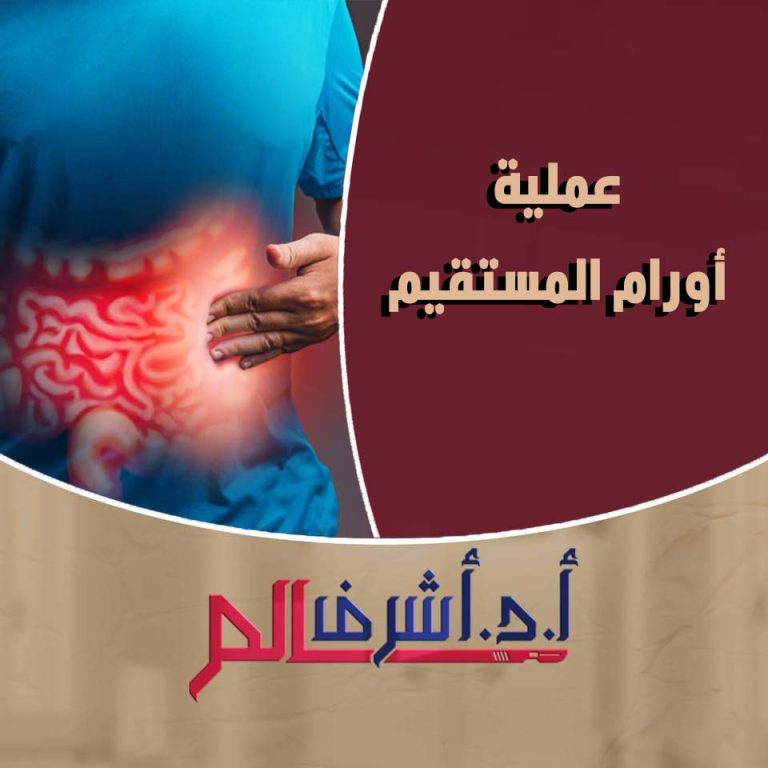 أورام المستقيم