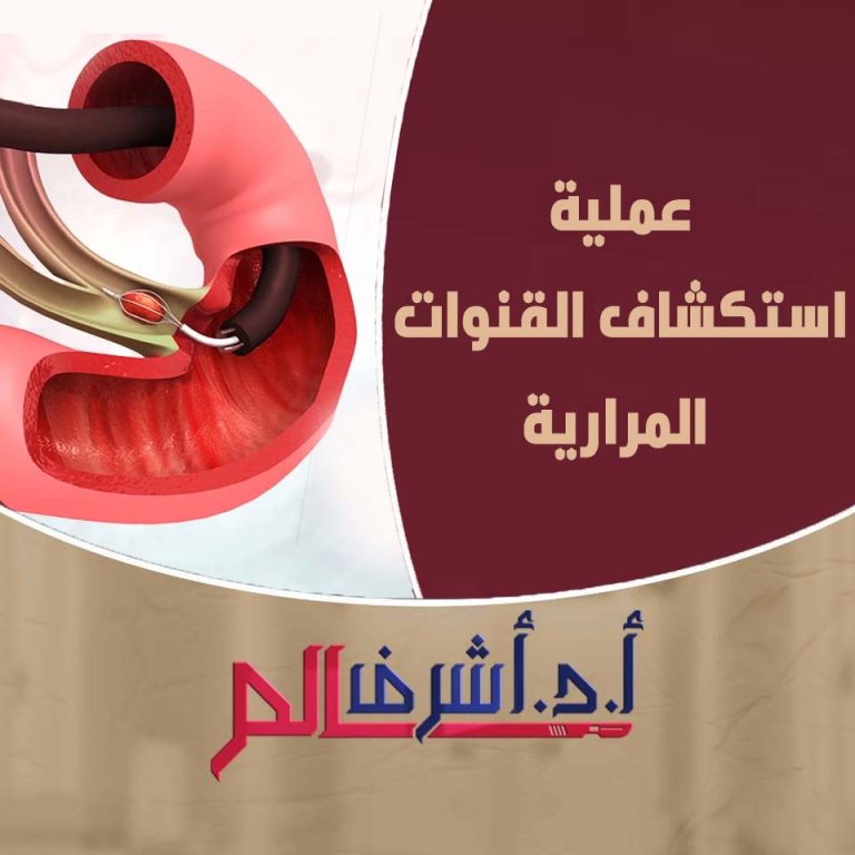 استكشاف القنوات المرارية
