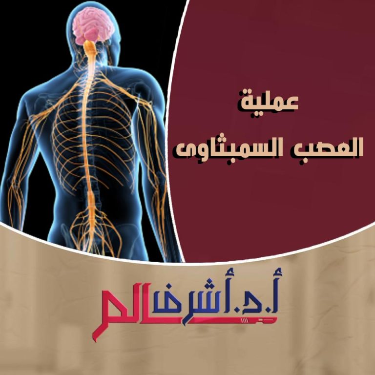 استئصال العصب السمبثاوي