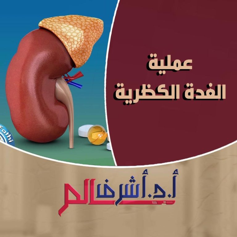 استئصال الغدة الكظرية