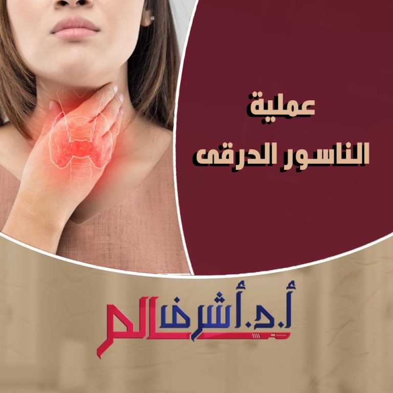 علاج الناسور الدرقي و الكيس الدرقي