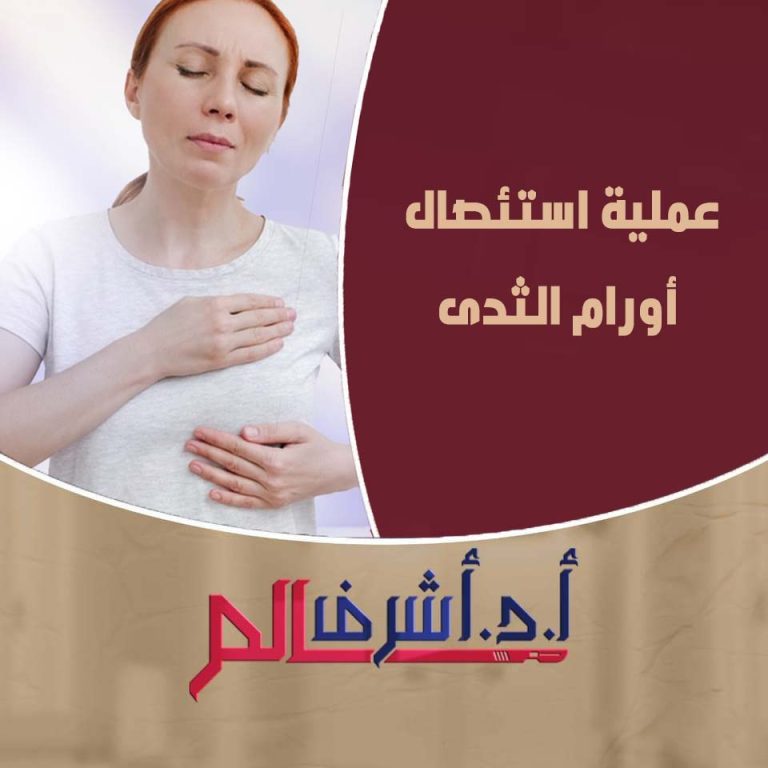 علاج أورام الثدي