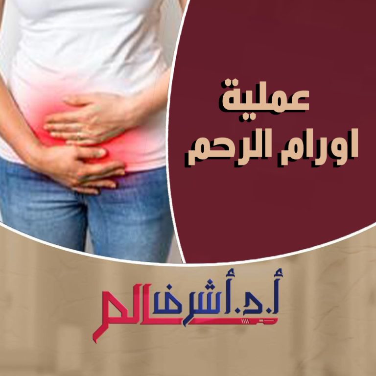 أورام الرحم