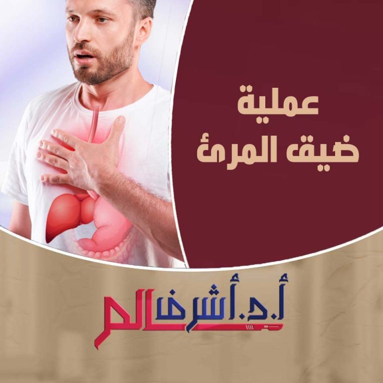 عمليات ضيق المرئ