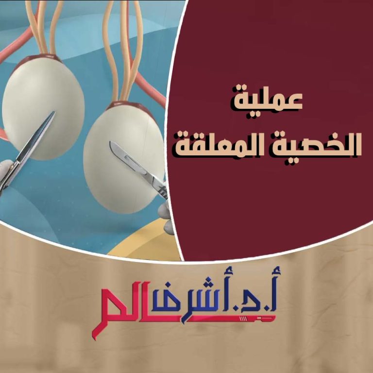 الخصية المعلقة