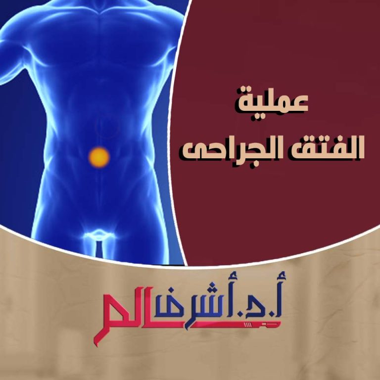 الفتق الجراحي