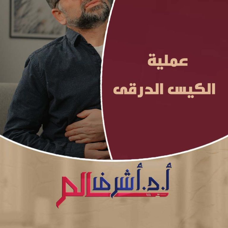 الكيس الدرقي: الأسباب، الأعراض والعلاج